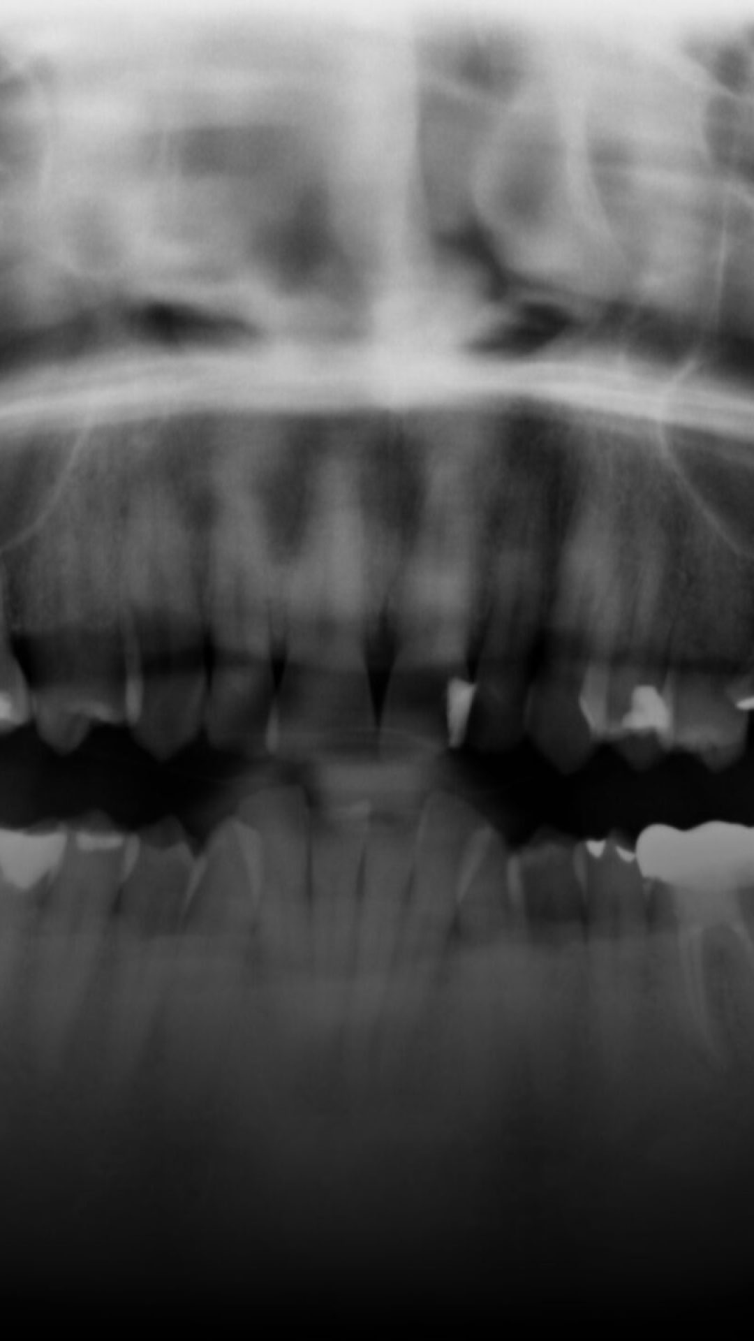 peter+mccabe+home+teeth