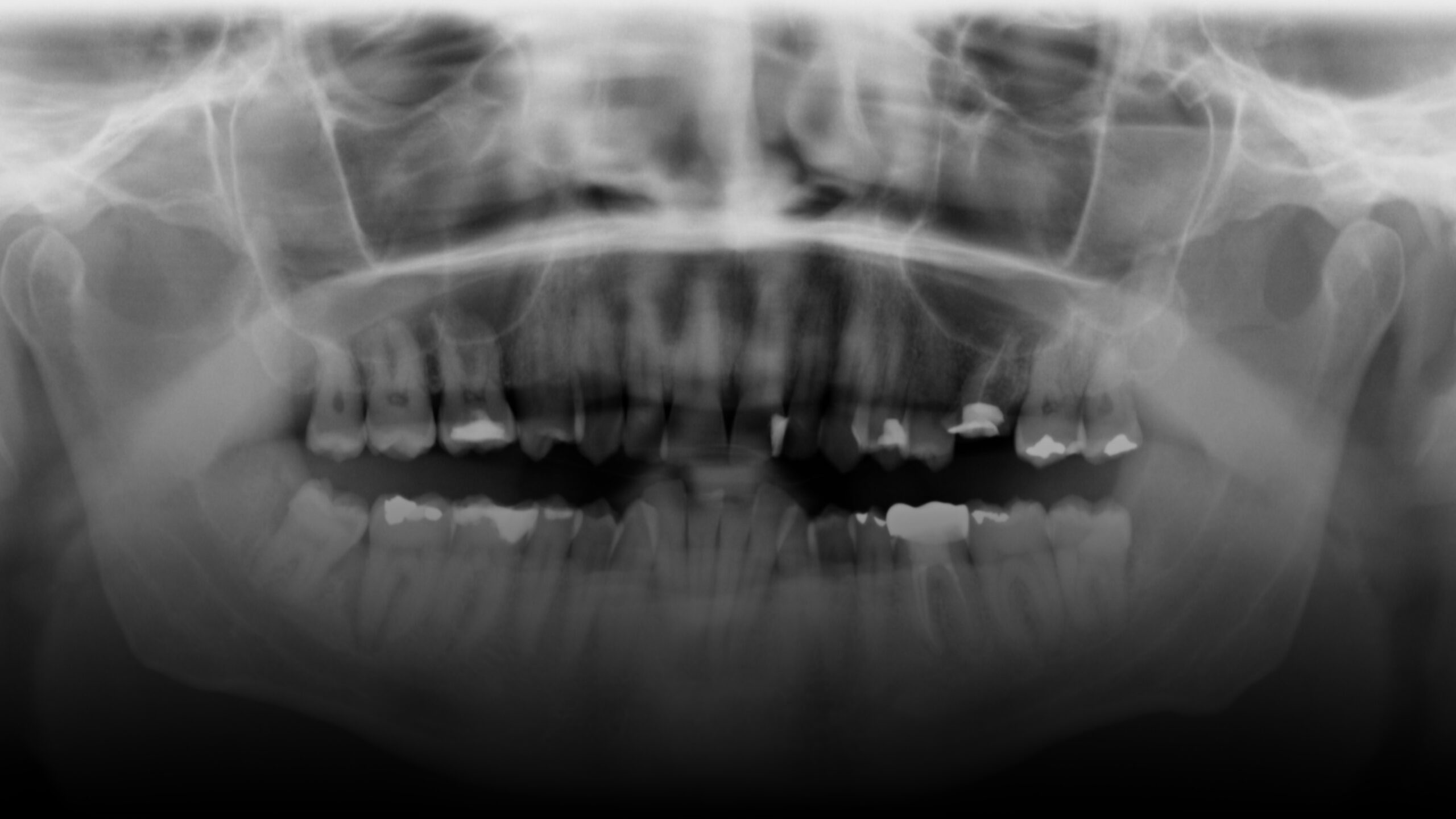 peter+mccabe+home+teeth